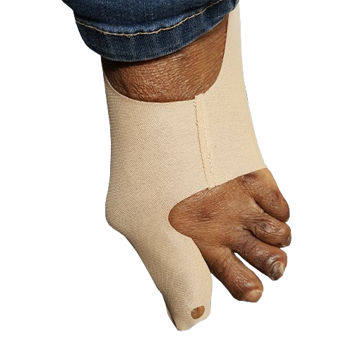 8 Hour Bunion Aligner - Image 4